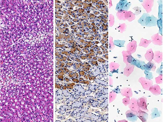 H&E,IHC,Special Stains H&E,IHC,Special Stains